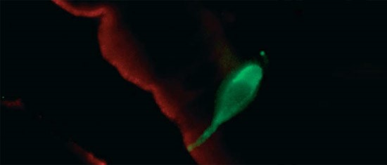 %e8%b1%ac%e5%b0%8f%e8%85%b8%e9%9a%b1%e7%aa%a9